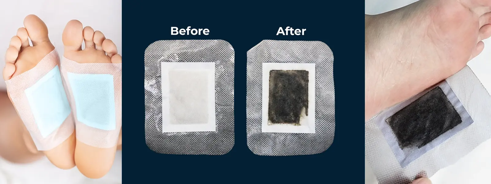 Xitox foot pads before and after